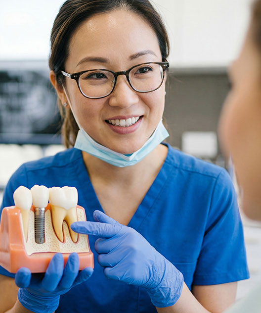 Dental Implants