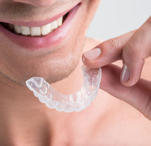 Invisalign