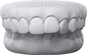 Overbite